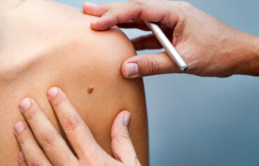 Consulto dermatologico