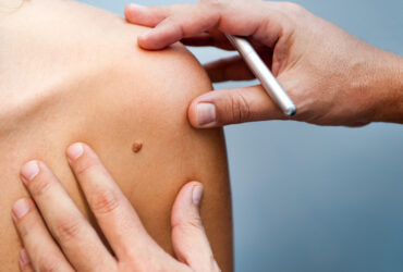 Consulto dermatologico