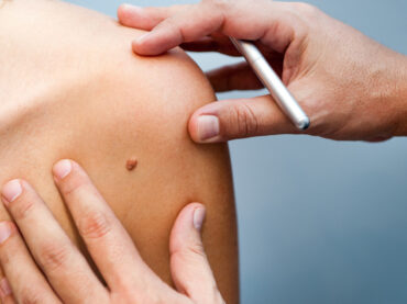 Consulto dermatologico