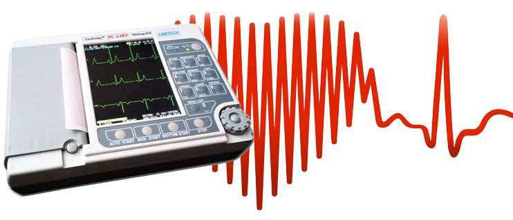 elettrocardiografo-elettrocardiogramma